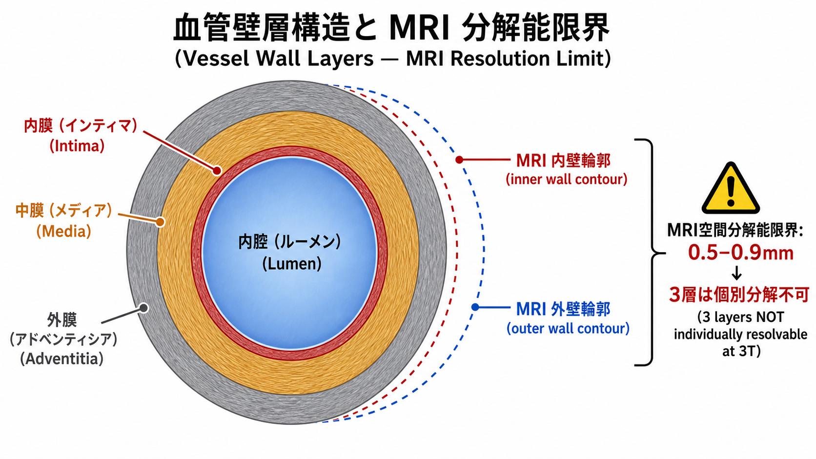 Vessel wall layer and MRI resolution